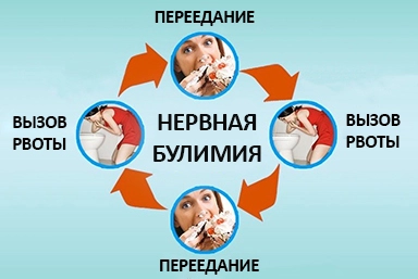 Лечение булимии в Старокучергановке
